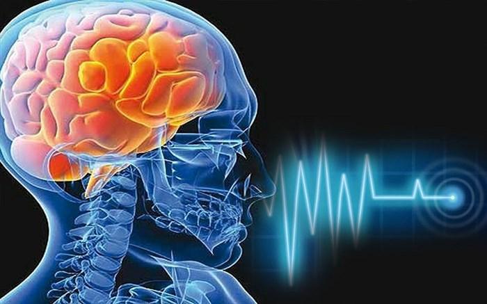 کرونا سکته مغزی را افزایش می دهد کرونا سکته مغزی را افزایش می دهد